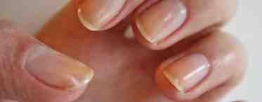 Ногти бывают разными… Почему меняется цвет?